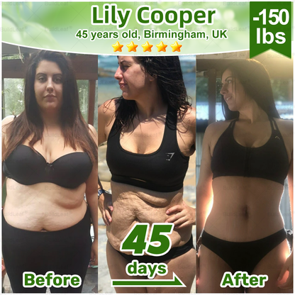 𝐎𝐟𝐟𝐢𝐜𝐢𝐚𝐥 𝐒𝐭𝐨𝐫𝐞 | 𝘽𝙪𝙞𝙡𝙙𝙇𝙚𝙖𝙛® 𝗚𝗟𝗣-𝟭 𝟐𝟎-𝐢𝐧-𝟏 𝐒𝐥𝐢𝐦 & 𝐇𝐞𝐚𝐥𝐭𝐡 𝐎𝐫𝐚𝐥 𝐒𝐨𝐥𝐮𝐭𝐢𝐨𝐧 (𝑶𝒏𝒄𝒆 𝒂 𝒅𝒂𝒚, 𝒓𝒆𝒔𝒖𝒍𝒕𝒔 𝒊𝒏 7 𝒅𝒂𝒚𝒔), 𝑾𝒊𝒕𝒉 100 𝑩𝒊𝒍𝒍𝒊𝒐𝒏 𝑪𝑭𝑼 𝑨𝒄𝒕𝒊𝒗𝒆 𝑷𝒓𝒐𝒃𝒊𝒐𝒕𝒊𝒄𝒔 ✅ 𝑺𝒖𝒑𝒑𝒐𝒓𝒕𝒔 𝒘𝒆𝒊𝒈𝒉𝒕 𝒎𝒂𝒏𝒂𝒈𝒆𝒎𝒆𝒏𝒕, 𝒉𝒆𝒂𝒓𝒕 𝒉𝒆𝒂𝒍𝒕𝒉, 𝒅𝒊𝒂𝒃𝒆𝒕𝒆𝒔, 𝒈𝒖𝒕 & 𝒘𝒐𝒎𝒆𝒏’𝒔 𝒉𝒆𝒂𝒍𝒕𝒉, 𝒘𝒉𝒊𝒍𝒆 𝒇𝒊𝒓𝒎𝒊𝒏𝒈 𝒔𝒌𝒊𝒏 & 𝒃𝒐𝒐𝒔𝒕𝒊𝒏𝒈 𝒆𝒏𝒆𝒓𝒈𝒚.