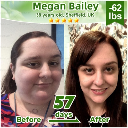 𝐎𝐟𝐟𝐢𝐜𝐢𝐚𝐥 𝐒𝐭𝐨𝐫𝐞 | 𝘽𝙪𝙞𝙡𝙙𝙇𝙚𝙖𝙛® 𝗚𝗟𝗣-𝟭 𝟐𝟎-𝐢𝐧-𝟏 𝐒𝐥𝐢𝐦 & 𝐇𝐞𝐚𝐥𝐭𝐡 𝐎𝐫𝐚𝐥 𝐒𝐨𝐥𝐮𝐭𝐢𝐨𝐧 (𝑶𝒏𝒄𝒆 𝒂 𝒅𝒂𝒚, 𝒓𝒆𝒔𝒖𝒍𝒕𝒔 𝒊𝒏 7 𝒅𝒂𝒚𝒔), 𝑾𝒊𝒕𝒉 100 𝑩𝒊𝒍𝒍𝒊𝒐𝒏 𝑪𝑭𝑼 𝑨𝒄𝒕𝒊𝒗𝒆 𝑷𝒓𝒐𝒃𝒊𝒐𝒕𝒊𝒄𝒔 ✅ 𝑺𝒖𝒑𝒑𝒐𝒓𝒕𝒔 𝒘𝒆𝒊𝒈𝒉𝒕 𝒎𝒂𝒏𝒂𝒈𝒆𝒎𝒆𝒏𝒕, 𝒉𝒆𝒂𝒓𝒕 𝒉𝒆𝒂𝒍𝒕𝒉, 𝒅𝒊𝒂𝒃𝒆𝒕𝒆𝒔, 𝒈𝒖𝒕 & 𝒘𝒐𝒎𝒆𝒏’𝒔 𝒉𝒆𝒂𝒍𝒕𝒉, 𝒘𝒉𝒊𝒍𝒆 𝒇𝒊𝒓𝒎𝒊𝒏𝒈 𝒔𝒌𝒊𝒏 & 𝒃𝒐𝒐𝒔𝒕𝒊𝒏𝒈 𝒆𝒏𝒆𝒓𝒈𝒚.