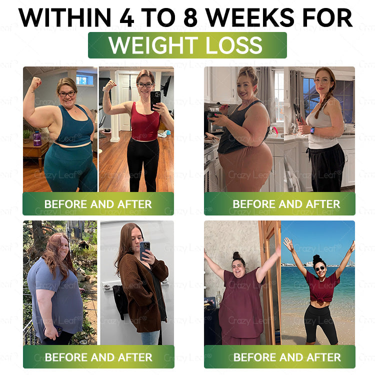 UK Clinically Proven|Official Store | CrazyLeaf® SMGT-GLP-1 Nano Microneedle Patch with Collagen & Matrixyl 3000 丨Targets Obesity, Loose Skin, High Blood Pressure, Diabetes, Fatty Liver, Joint Pain, Brain Fog, Low Energy, Body Aches, and More