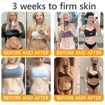 🔥 Made & Shipped from UK | Clinically Proven: PolarFresh® Bee Venom Wrinkle-Firming Multi-purpose Cream with bee venom peptides, botulinum toxin, hyaluronic acid, and collagen💧. Targets wrinkles, fine lines, sagging, stretch marks, dark spots and more