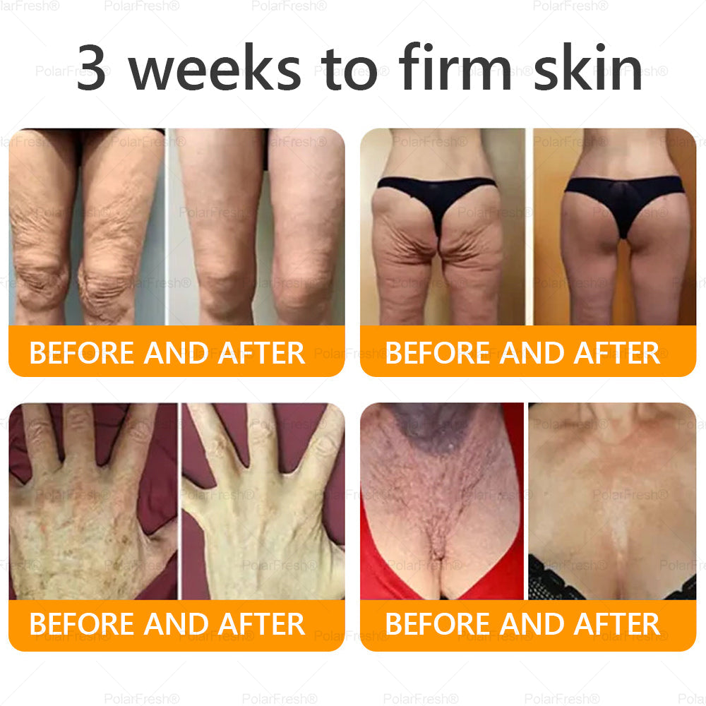 🔥 Made & Shipped from UK | Clinically Proven: PolarFresh® Bee Venom Wrinkle-Firming Multi-purpose Cream with bee venom peptides, botulinum toxin, hyaluronic acid, and collagen💧. Targets wrinkles, fine lines, sagging, stretch marks, dark spots and more