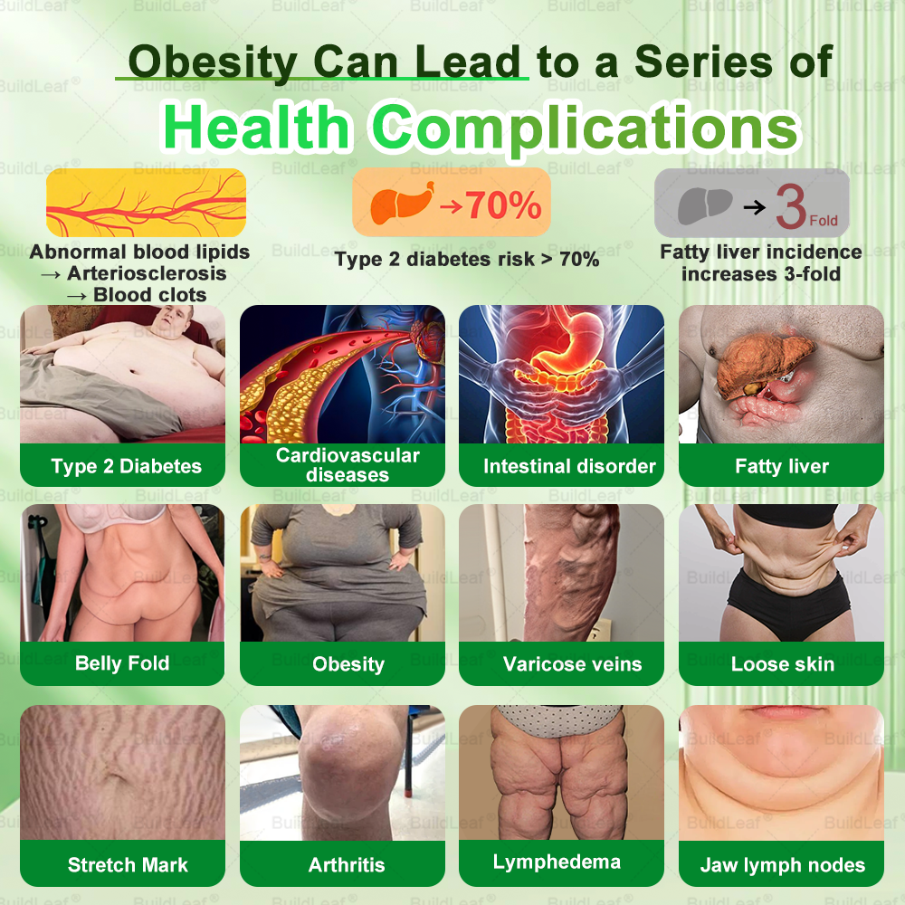 𝐎𝐟𝐟𝐢𝐜𝐢𝐚𝐥 𝐒𝐭𝐨𝐫𝐞 | 𝘽𝙪𝙞𝙡𝙙𝙇𝙚𝙖𝙛® 𝗚𝗟𝗣-𝟭 𝟐𝟎-𝐢𝐧-𝟏 𝐒𝐥𝐢𝐦 & 𝐇𝐞𝐚𝐥𝐭𝐡 𝐎𝐫𝐚𝐥 𝐒𝐨𝐥𝐮𝐭𝐢𝐨𝐧 (𝑶𝒏𝒄𝒆 𝒂 𝒅𝒂𝒚, 𝒓𝒆𝒔𝒖𝒍𝒕𝒔 𝒊𝒏 7 𝒅𝒂𝒚𝒔), 𝑾𝒊𝒕𝒉 100 𝑩𝒊𝒍𝒍𝒊𝒐𝒏 𝑪𝑭𝑼 𝑨𝒄𝒕𝒊𝒗𝒆 𝑷𝒓𝒐𝒃𝒊𝒐𝒕𝒊𝒄𝒔 ✅ 𝑺𝒖𝒑𝒑𝒐𝒓𝒕𝒔 𝒘𝒆𝒊𝒈𝒉𝒕 𝒎𝒂𝒏𝒂𝒈𝒆𝒎𝒆𝒏𝒕, 𝒉𝒆𝒂𝒓𝒕 𝒉𝒆𝒂𝒍𝒕𝒉, 𝒅𝒊𝒂𝒃𝒆𝒕𝒆𝒔, 𝒈𝒖𝒕 & 𝒘𝒐𝒎𝒆𝒏’𝒔 𝒉𝒆𝒂𝒍𝒕𝒉, 𝒘𝒉𝒊𝒍𝒆 𝒇𝒊𝒓𝒎𝒊𝒏𝒈 𝒔𝒌𝒊𝒏 & 𝒃𝒐𝒐𝒔𝒕𝒊𝒏𝒈 𝒆𝒏𝒆𝒓𝒈𝒚.